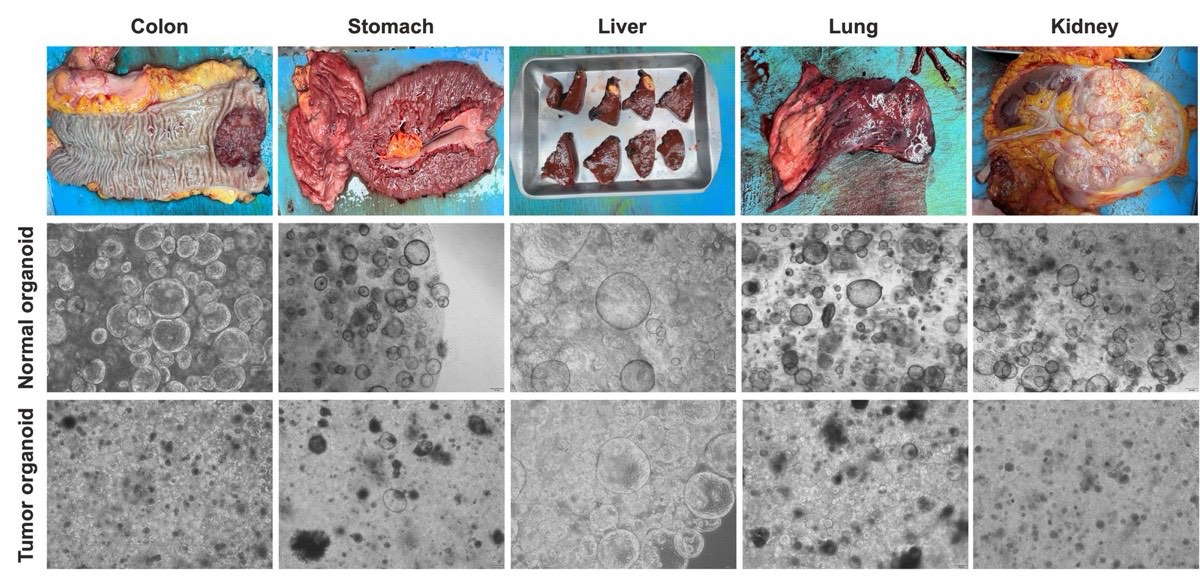 Normal and tumor organoids cultured from colon, stomach, liver, lung and kidney surgical specimens in the O2B Lab